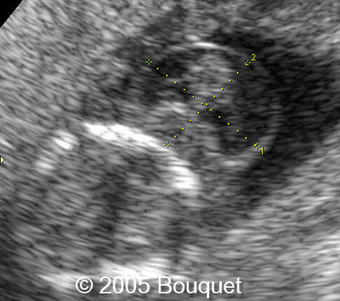 Fig2