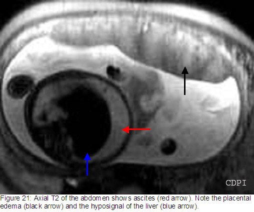 fig21
