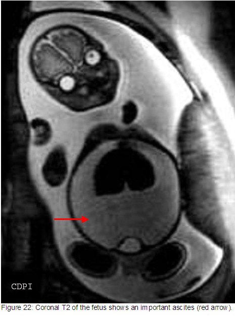 fig22