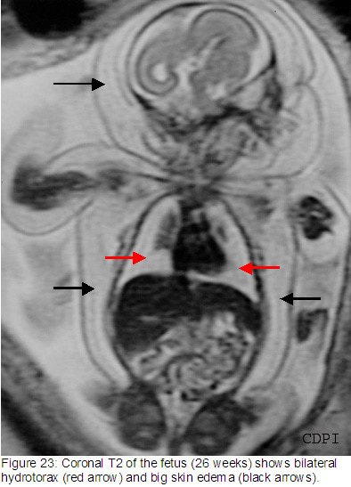 fig23
