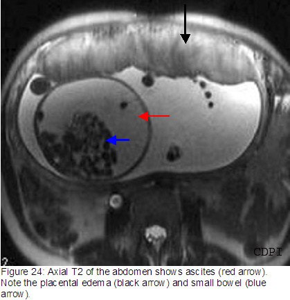 fig24