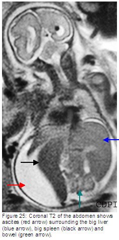 fig25