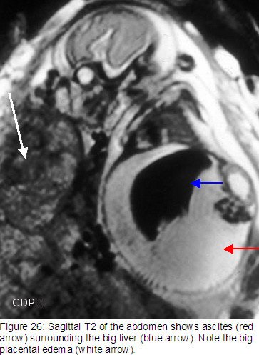 fig26