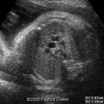 fig28