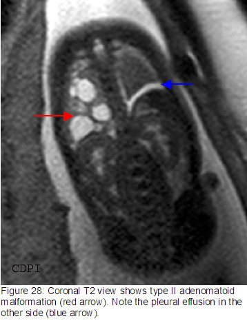 fig28