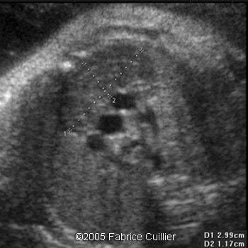 fig29