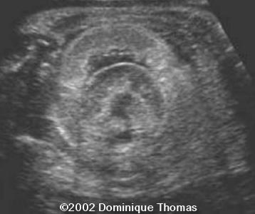 fig3 (2)