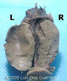 fig3_right