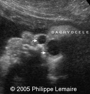 fig3