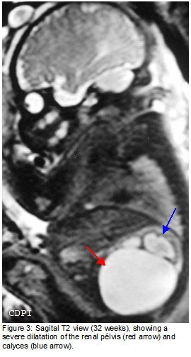 fig3