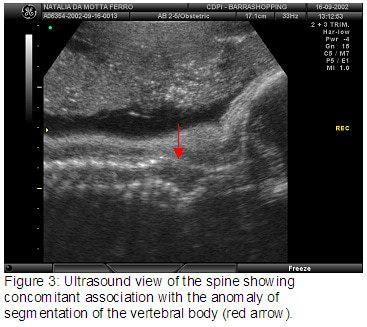 fig3