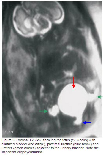 fig3