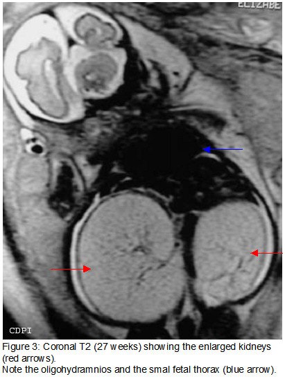fig3