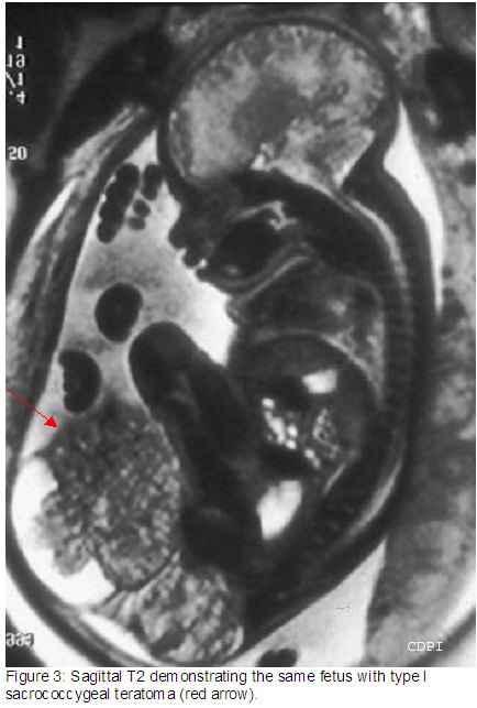 fig3
