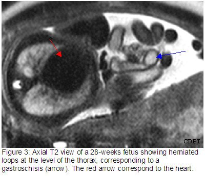 fig3