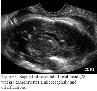 fig3