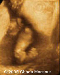 fig3
