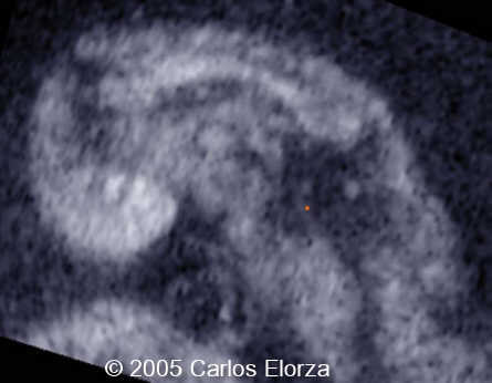 fig3