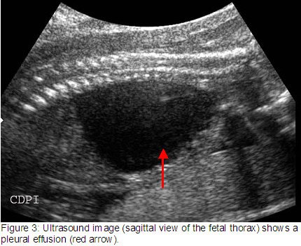 fig3