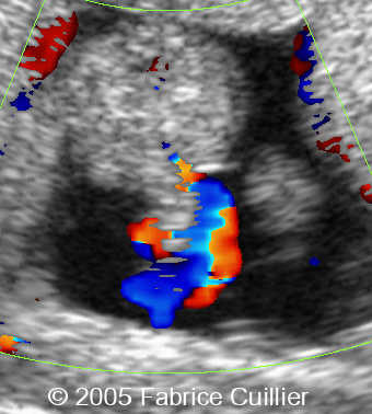 fig3