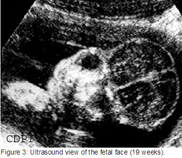 fig3