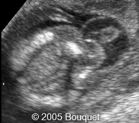 Fig3