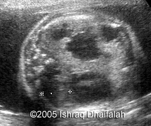 fig3