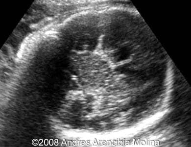 Fig3
