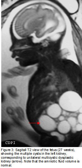 fig3