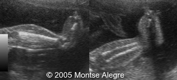 fig3
