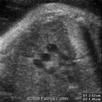 fig31