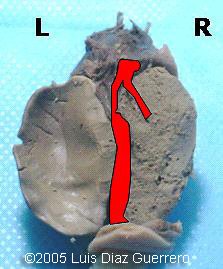 fig3b1