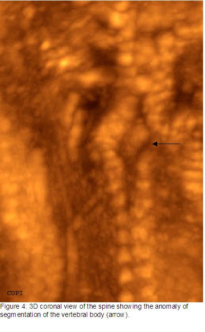 fig4