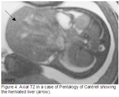 fig4