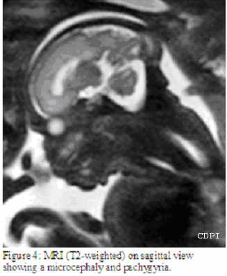 fig4
