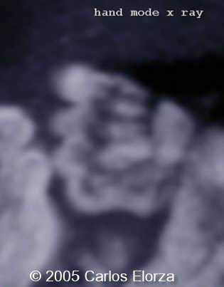 fig4