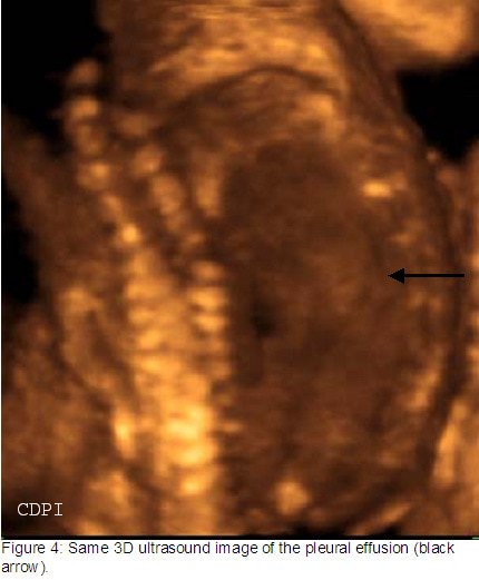 fig4