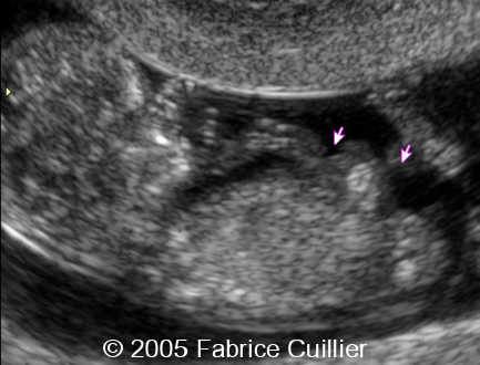 fig4