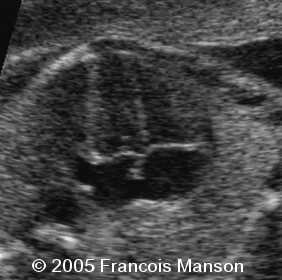 fig4