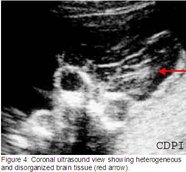 fig4