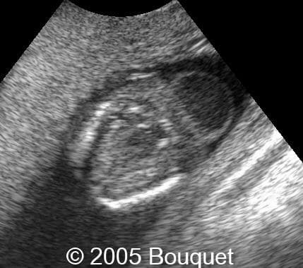 Fig4