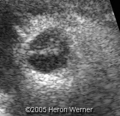 fig4