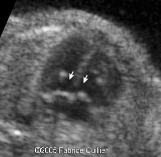 fig4