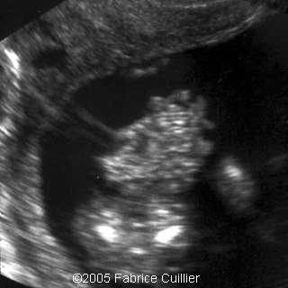 fig4