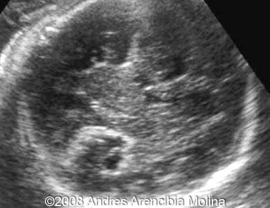 Fig4