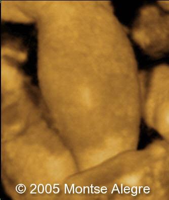 fig4