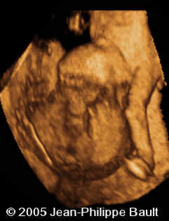 fig4