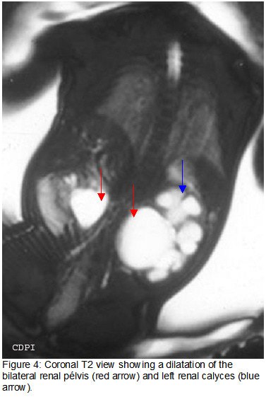 fig4
