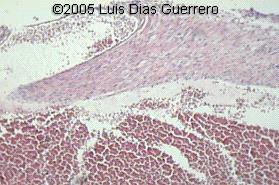 fig4a1