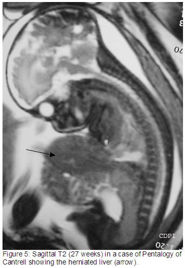 fig5